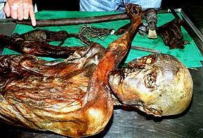 Otzi ou la malediction de la momie